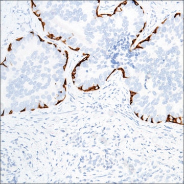 Anti-Keratin 17 antibody, Rabbit monoclonal recombinant, expressed in proprietary host, clone SP95, affinity isolated antibody