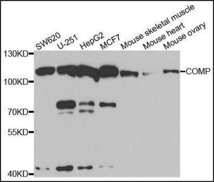 Anti-COMP antibody produced in rabbit affinity isolated antibody