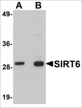 Anti-SIRT6 antibody produced in chicken affinity isolated antibody, buffered aqueous solution