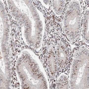 Anti-KLF7 antibody produced in rabbit Prestige Antibodies&#174; Powered by Atlas Antibodies, affinity isolated antibody, buffered aqueous glycerol solution