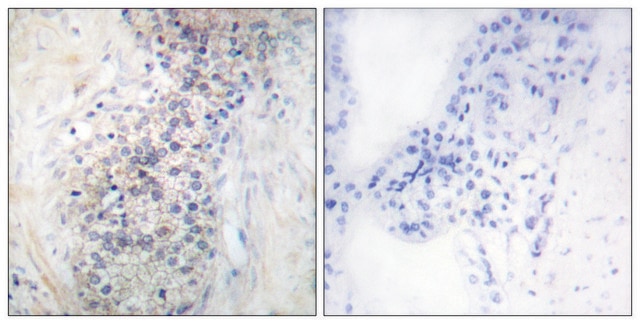 Anti-LRAT antibody produced in rabbit affinity isolated antibody