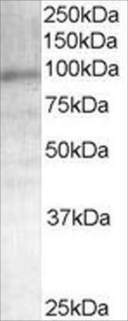 Anti-Androgen Receptor antibody produced in goat affinity isolated antibody, buffered aqueous solution