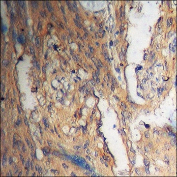 Anti-phospho-Akt (pThr308) antibody produced in rabbit affinity isolated antibody