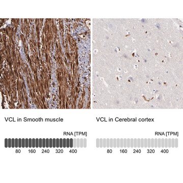 Anti-VCL antibody produced in rabbit Prestige Antibodies&#174; Powered by Atlas Antibodies, affinity isolated antibody, buffered aqueous glycerol solution