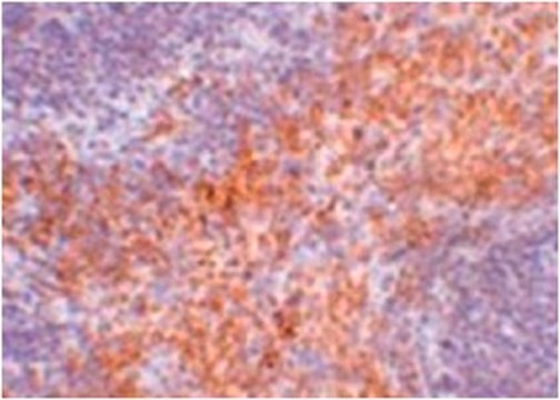 Anti-RIPK1 Antibody from rabbit, purified by affinity chromatography