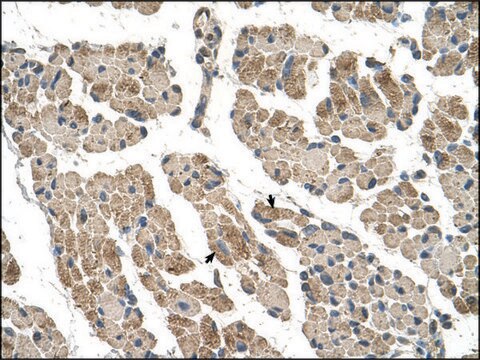 Anti-CLCC1 antibody produced in rabbit IgG fraction of antiserum