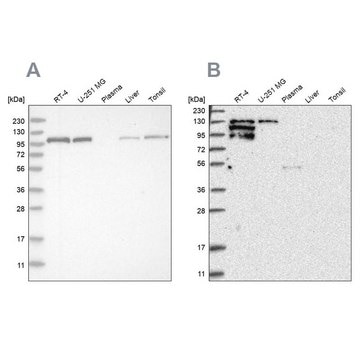 Anti-PTK2B antibody produced in rabbit Prestige Antibodies&#174; Powered by Atlas Antibodies, affinity isolated antibody, buffered aqueous glycerol solution, ab2