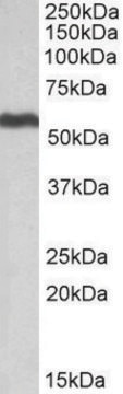 Anti-ALDH5A1 antibody produced in goat affinity isolated antibody, buffered aqueous solution