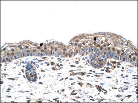 Anti-IRF4 antibody produced in rabbit affinity isolated antibody