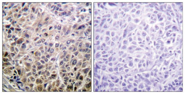 Anti-DAPK1 antibody produced in rabbit affinity isolated antibody