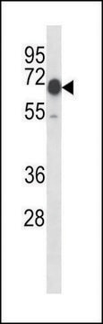 ANTI-MOUSE CAMKK2 (N-TERM) antibody produced in rabbit IgG fraction of antiserum, buffered aqueous solution