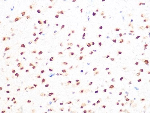 Anti-PRMT1 antibody produced in rabbit