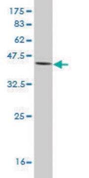 Monoclonal Anti-IL18BP antibody produced in mouse clone 2A9, purified immunoglobulin, buffered aqueous solution