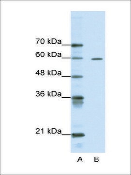 Anti-ARID3A antibody produced in rabbit affinity isolated antibody