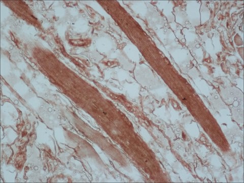 Monoclonal Anti-Tropomyosin (Sarcomeric) antibody produced in mouse clone CH1, ascites fluid