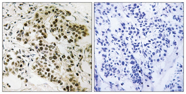 Anti-Retinoblastoma antibody produced in rabbit affinity isolated antibody