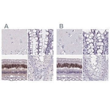 Anti-CRX antibody produced in rabbit Prestige Antibodies&#174; Powered by Atlas Antibodies, affinity isolated antibody, buffered aqueous glycerol solution