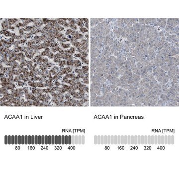 Anti-ACAA1 antibody produced in rabbit Ab2, Prestige Antibodies&#174; Powered by Atlas Antibodies, affinity isolated antibody, buffered aqueous glycerol solution