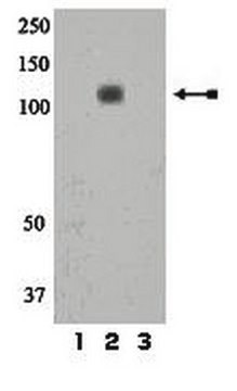 Anti-phospho-IR/IGF1R (Tyr1158) Antibody Upstate&#174;, from rabbit