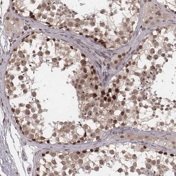 Anti-HMGA2 antibody produced in rabbit Prestige Antibodies&#174; Powered by Atlas Antibodies, affinity isolated antibody, buffered aqueous glycerol solution