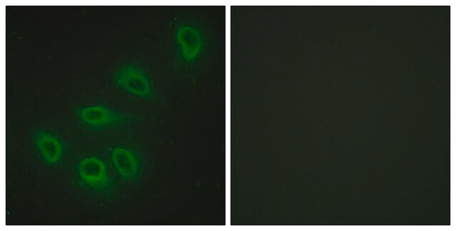 Anti-ENOS antibody produced in rabbit affinity isolated antibody